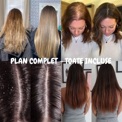Plan Profesional Personalizat – Include Toate Planurile(Anti-Cădere, Creștere, Reparare, Regenerare Scalp)